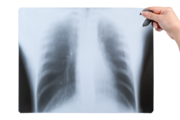 in a female hand x-ray of the lungs isolated on a white background
