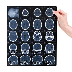 A woman's hand holds an MRI scan of the brain isolated on a white background