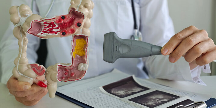 A doctor uses a model of the colon and an ultrasound probe to explain the anatomy of the colon to a patient concept