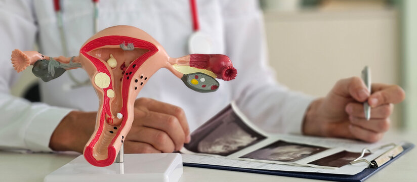 Doctor explaining changes in ovaries to patient on artificial model of uterus and showing ultrasound picture