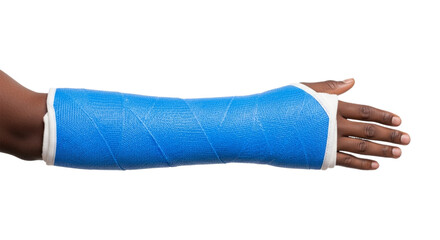 Person of color's arm in a blue fiberglass cast. cutout on transparent background.