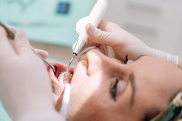 Close up of Dentist cleans patient's teeth using a dental scaler and water jet in a modern clinic