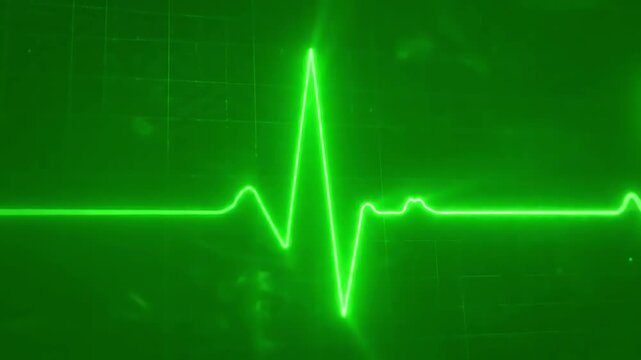 Green Screen 3d render of a heartbeat frequency on cardiograph recording pulse scene 2 with distortion, overlay, glitch, static noise, scan lines black background, 4k animated video loop