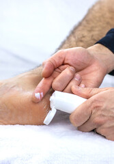Male feet dry skin on the heels. Selective focus.