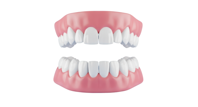 Realistic Dental Denture Set With Pink Gums isolated on a transparent background dentures