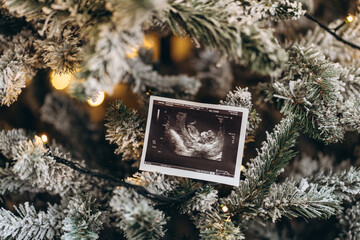 Baby ultrasound photo placed on a snow-covered Christmas tree with warm fairy lights, symbolizing a holiday pregnancy announcement