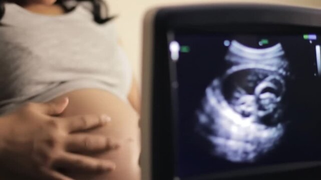 Pregnant Woman Looking at Ultrasound Screen During Professional Prenatal Consultation