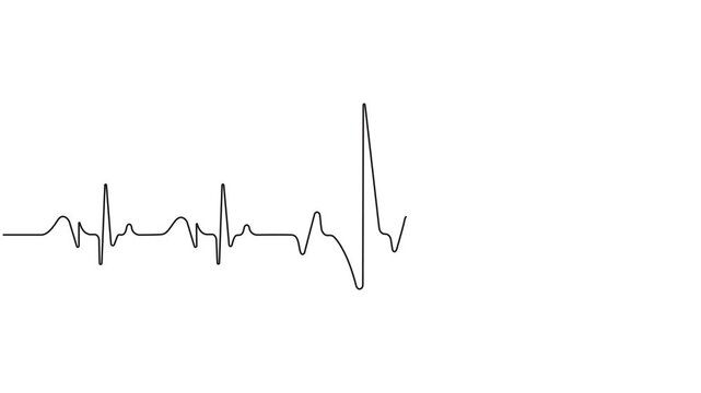 Self drawing line animation Heartbeat cardiogram, continuous one line drawing concept, Heart pulse and rate symbol animated video, Animation of a single line drawing of a cardiogram.