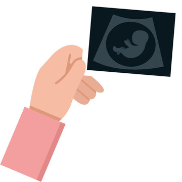 Hand Holding Ultrasound Scan Result