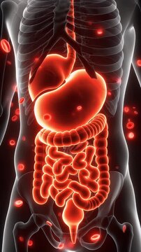 Pain intestines, bowel inflammation, stomach ache. Gut health. Intestinal walls thicken causing discomfort. Stomach lining irritation affects digestion. Gastrointestinal stability crucial for health