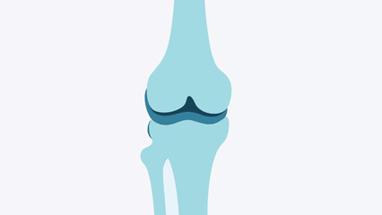 Simple Orthopedic Knee Joint Vector Illustration
