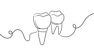 2 Teeth set continious line drawing. Dentistry, caries, filling, implant outline. Vector illustration. 
