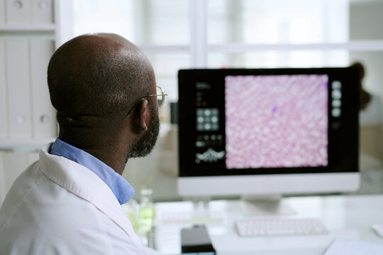 Middle aged Black man wearing lab coat analyzing microscopic image on computer monitor in laboratory setting, focusing on medical research or diagnostic process