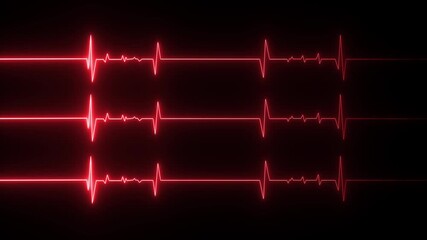 An electrocardiogram (ECG or EKG) waveform is a visual representation of the electrical activity of the heart. It is a common symbol for a heartbeat or pulse monitor signal. 
