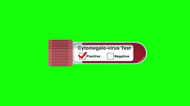 Cytomegalovirus test tube positive result animation on a green screen background for medical diagnostics, viral infection screening