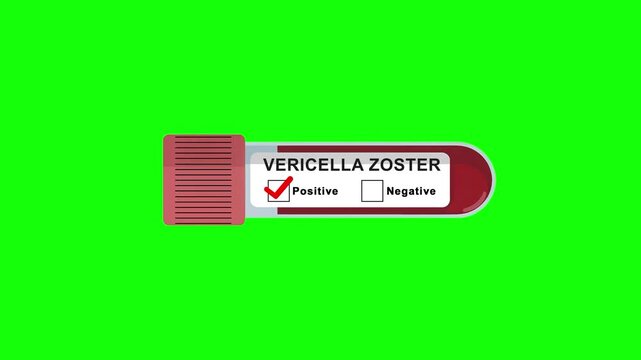 Varicella Zoster test tube positive result animation on a green screen background for medical diagnostics and viral infection screening