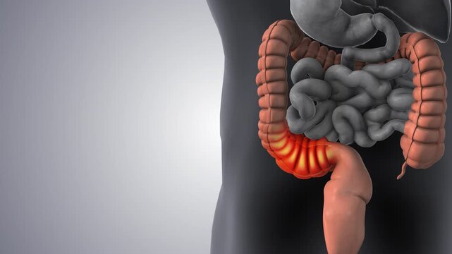 Lower Abdominal Sigmoid Colon Algia Condition