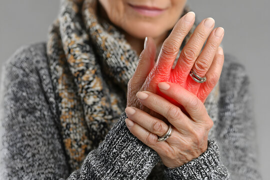 Close-up of an elderly woman&rsquo;s hands with one hand gripping the other in pain, showing red inflammation, possibly due to arthritis or joint pain.
