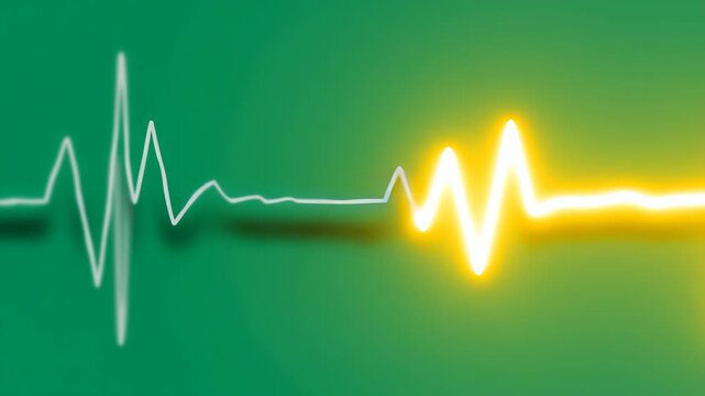 Heartbeat Line on Green Background, Ideal for Medical and Health Themes - Powered by Adobe