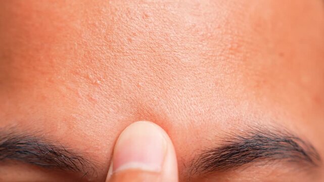 A close-up of a thumb pressing the Third Eye point between the eyebrows to relieve eye strain, illustrating mindfulness, clarity, relaxation, tension release, focus, calmness, and self-care.
