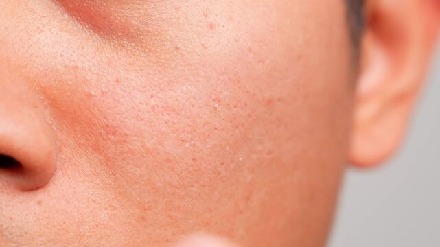 A close-up of fingers massaging along the cheekbones from the side of the nose toward the ear to ease congestion and sinus pressure, reflecting relief, wellness, self-care, circulation, relaxation.
