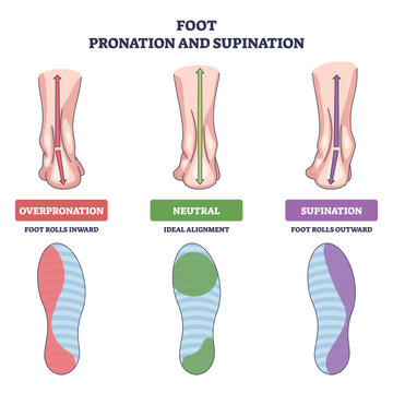 Foot pronation and supination illustrated with heels, arrows, and footprints to contrast inward roll, neutral stance, and outward roll for gait alignment. Outline diagram