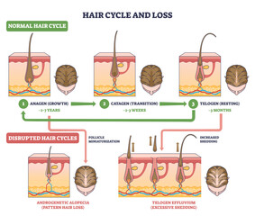 Hair cycle and loss visual explains anagen, catagen, telogen and how disruption causes shedding, key objects, follicles, scalp sections, arrows. Outline diagram