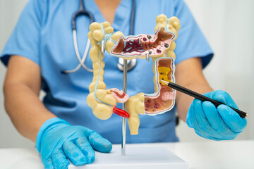 Intestine, Asian woman holding human anatomy model.
