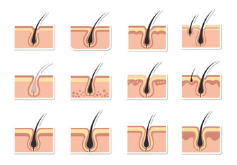 Different Stages of Hair Growth Illustrated in Simple Graphic Style