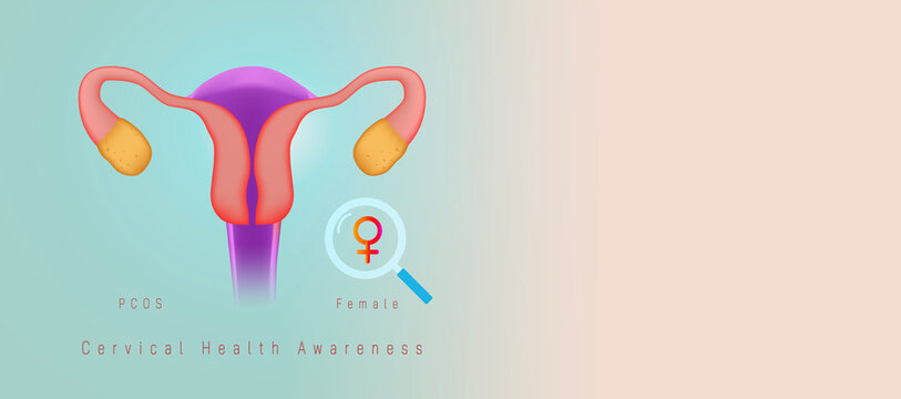 Cervical health awareness concept. uterus reproductive system, highlighting PCOS, ovarian disorders, gynecologic cancer prevention, women’s medical consultation on a vintage-style obstetric banner. - Powered by Adobe