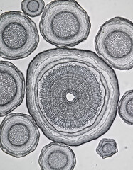 Transmission Electron Microscopy (TEM) Cross-section of Avian Flu Virus Particles.