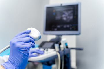Ultrasound probe near monitor. Gloved hand lifts ultrasound probe with blurred sonography image on screen behind. © Vadim