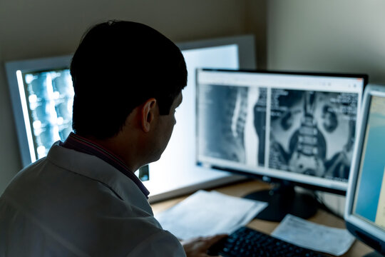 Radiologist at work. Radiologist analyzing MRI images on dual monitor setup.
