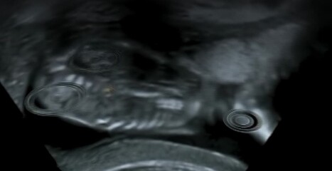 Multiple medical monitors displaying detailed pregnancy ultrasound images inside a modern clinical environment