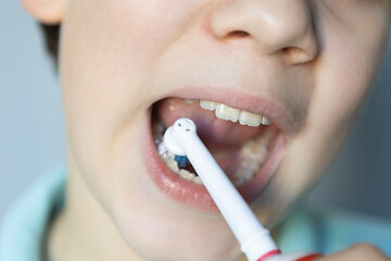 Young child brushes teeth with electric toothbrush in bright bathroom during morning routine