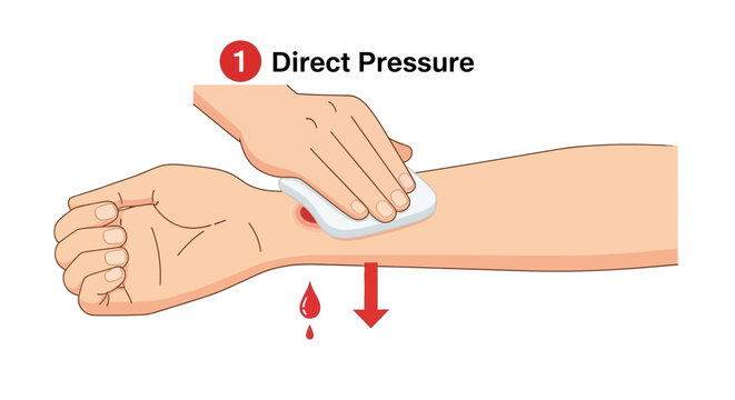 Closeup showing direct pressure being applied to bleeding wound on an arm with cloth and blood drops falling