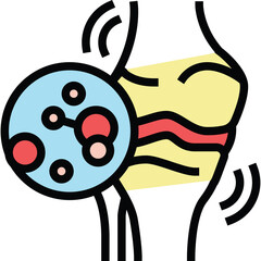 Arthritis joint pain illustration showing inflammation and damage to cartilage with red inflamed...