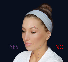 Botulinum toxin injection for facial wrinkles  ,in the therapy of mimic facial lines.full face...