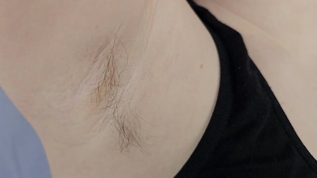 Effective methods for underarm hair removal at home using simple techniques