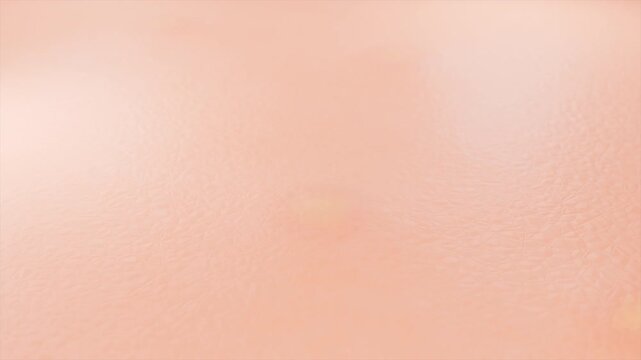 Acne Spot Cream Heals Pimple for Flawless Skin