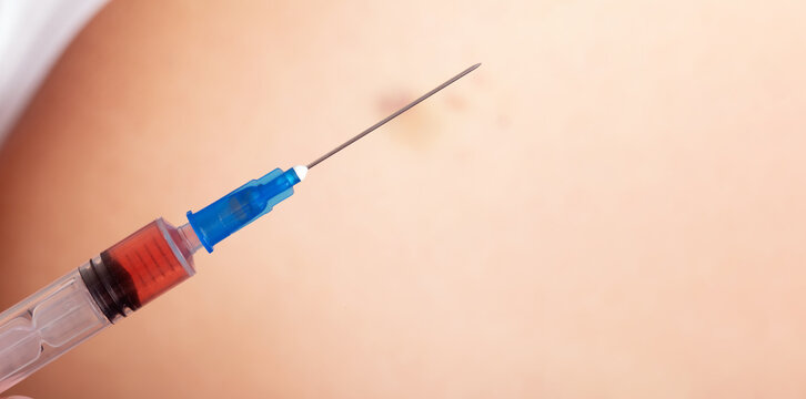 Close up of a syringe with needle and clear solution against human skin, suitable for healthcare and vaccination concepts.