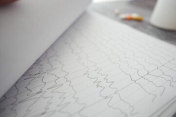 Medical recording of brain activity on paper chart
