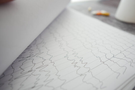 Medical recording of brain activity on paper chart