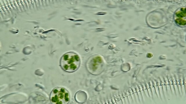 원형동물,짚신벌레,벌레,단세표,원생생물,protozoa, strawworms, worms, pedicures, protozoa