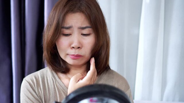 Asian woman with Bell&rsquo;s palsy or facial palsy, showing visible facial weakness and a drooping mouth while checking herself in the mirror. sudden facial paralysis, nerve inflammation, viral infection 