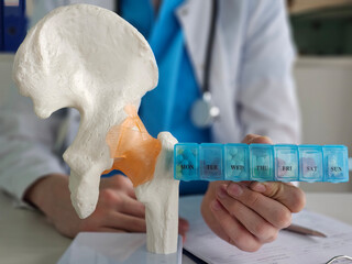 Doctor demonstrates hip joint model while holding a weekly pill organizer during patient consultation concept
