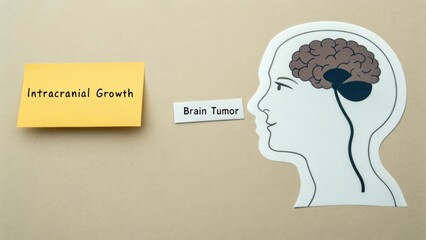 Diagram of a brain with a tumor and information about it