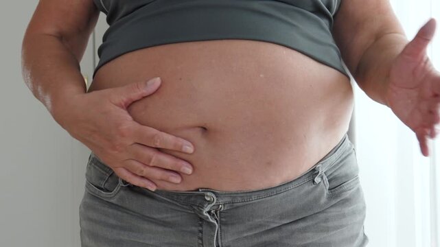 Mature woman with stretch marks slaps stomach with hands in close up. Applying firming cream or moisturizing lotion to large belly, performs massage to reduce cellulite and increase skin elasticity