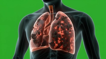 Lungs Affected by Pollution - A Medical Visualization of Respiratory Damage.
