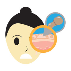 tinea versicolor on skin 